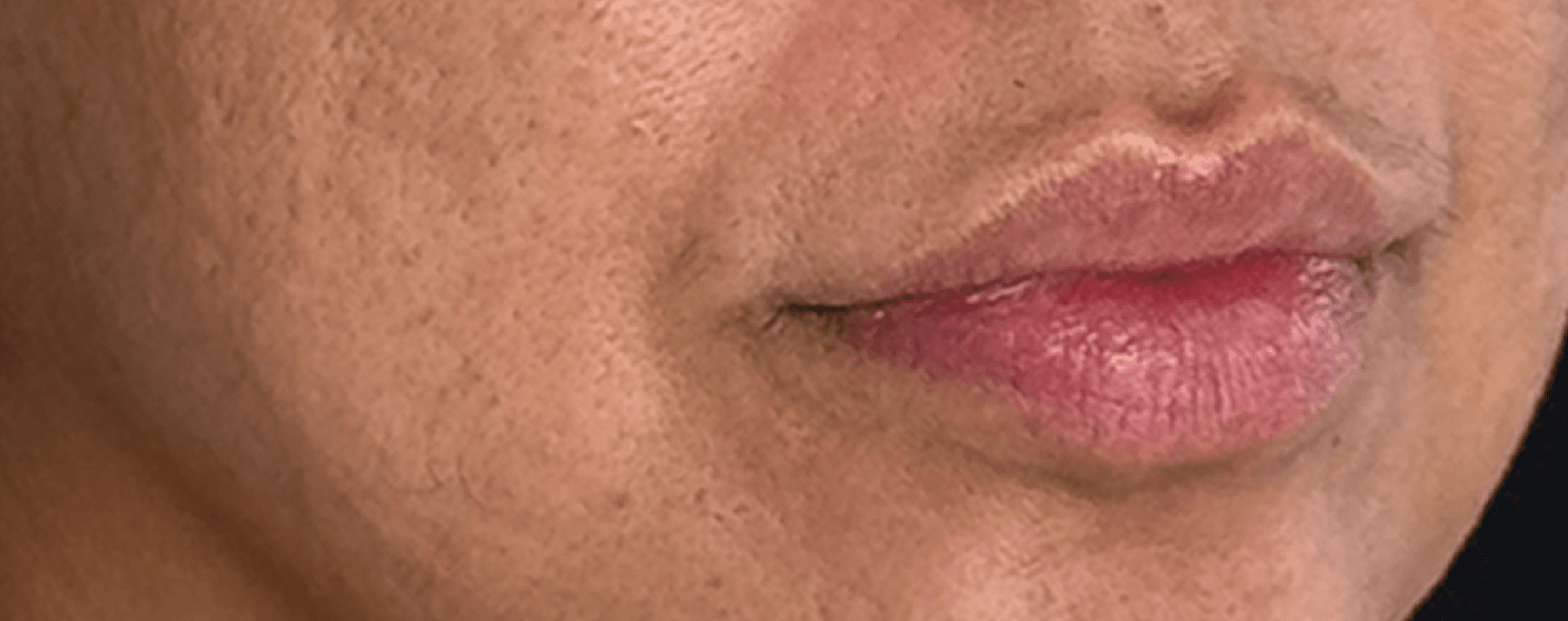 Facial Glow & Hydration — before