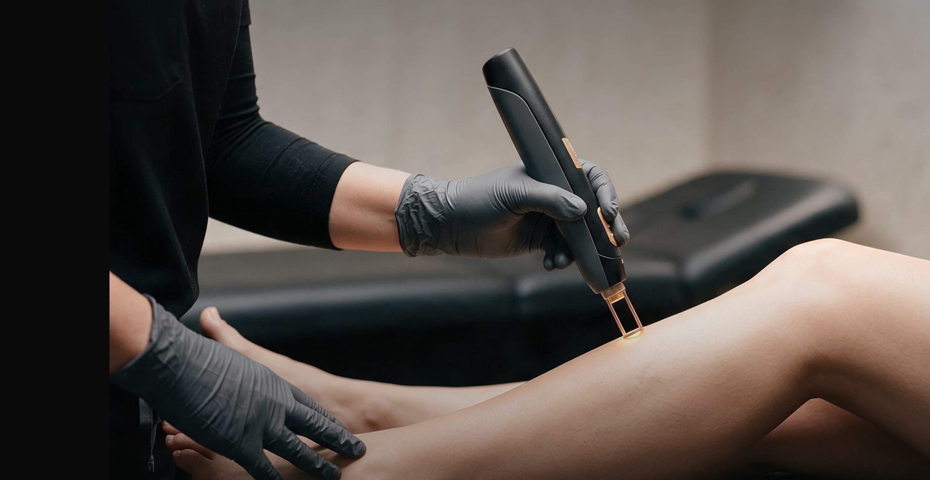 A practitioner in black gloves treating a patient's leg with a handheld vascular laser device
