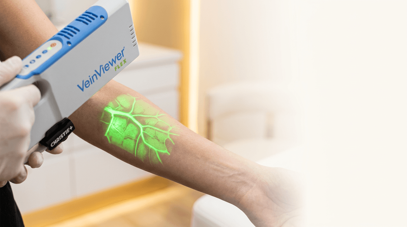 The VeinViewer Flex projecting a green vein map onto a patient's forearm